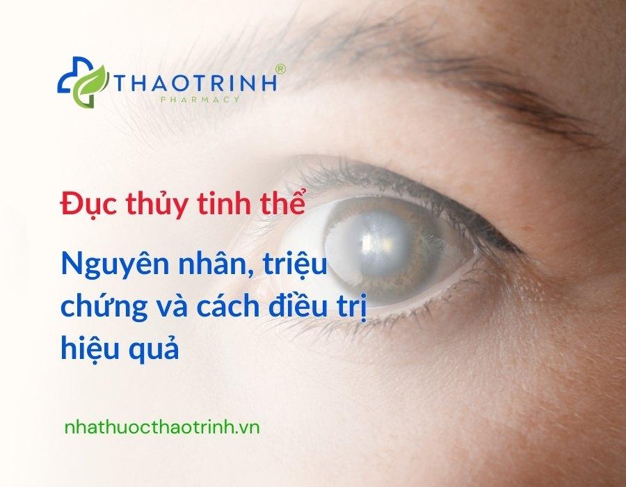 Đục thủy tinh thể - Nguyên nhân, triệu chứng và cách điều trị hiệu quả